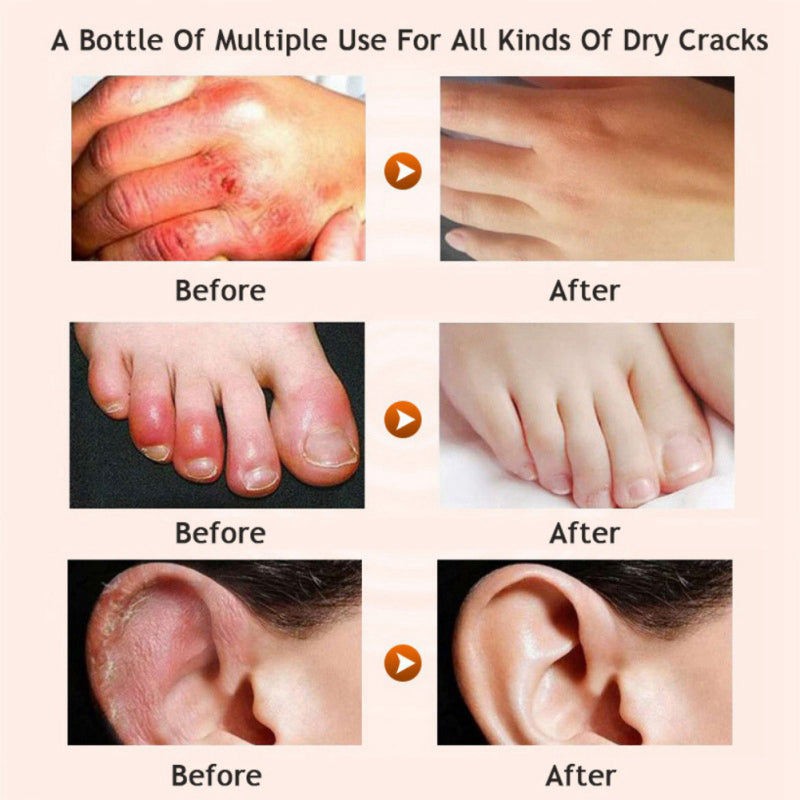 كريم قدمين مرطب بالعسل والأفوكادو | Honey Avocado Foot Cream