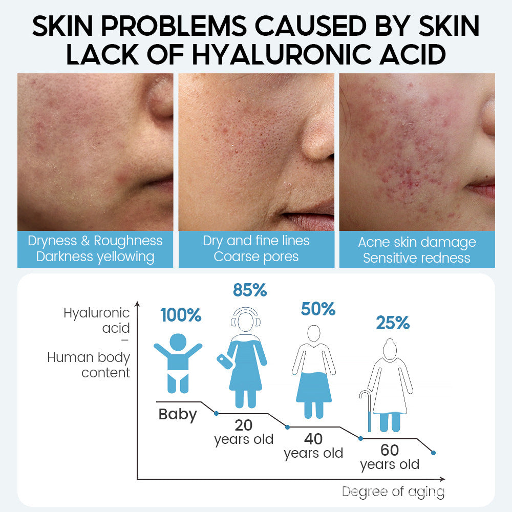 سيروم حمض الهيالورونيك لمكافحة الشيخوخة وتضييق المسامات | Hyaluronic Acid Face Serum Anti-Aging Shrink Pore