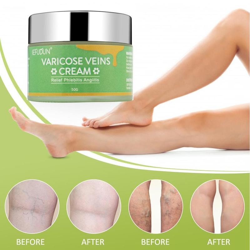 كريم علاج الدوالي والأوردة بالزعفران | Varicose Vein Cream Safflower 50g
